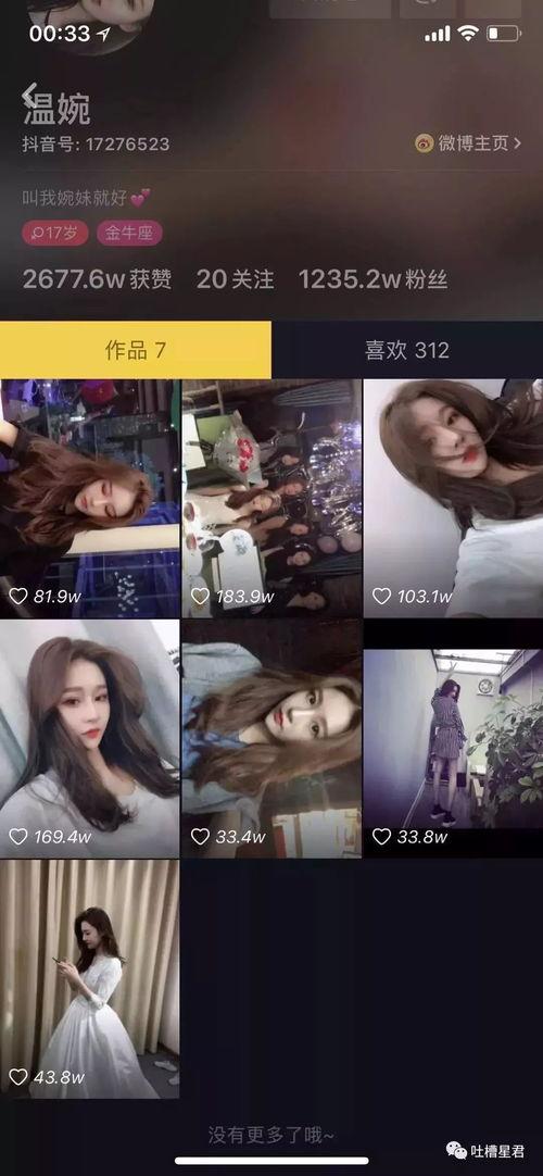 抖音网红吃瓜儿